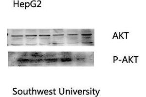 Western Blot (WB) analysis: Please contact us for more details. (AKT1 Antikörper  (Internal Region))