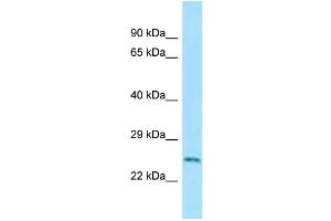 WB Suggested Anti-Rab5a Antibody Titration: 1. (RAB5 Antikörper  (C-Term))