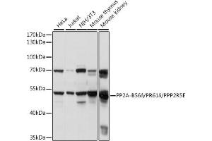 Western blot analysis of extracts of various cell lines, using PP2A-B56δ/PR61δ/PPP2R5E antibody (ABIN7269691) at 1:1000 dilution. (PPP2R5E Antikörper  (AA 398-467))