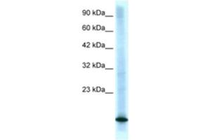 Western Blotting (WB) image for anti-Cyclin-Dependent Kinase Inhibitor 2B (p15, Inhibits CDK4) (CDKN2B) antibody (ABIN2463682) (CDKN2B Antikörper)