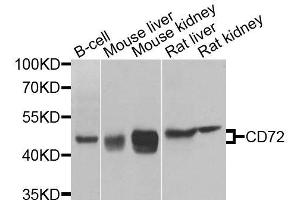 Western blot analysis of extracts of various cell lines, using CD72 antibody (ABIN6003638) at 1/1000 dilution. (CD72 Antikörper)