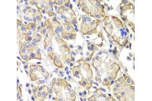 Immunohistochemistry of paraffin-embedded Human stomach using Lyn Polyclonal Antibody at dilution of 1:100 (40x lens). (LYN Antikörper)