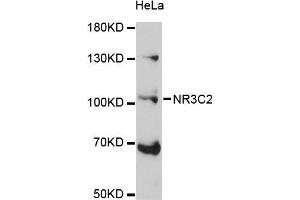 Western blot analysis of extracts of HeLa cells, using NR3C2 antibody (ABIN5971700) at 1:3000 dilution. (NR3C2 Antikörper)