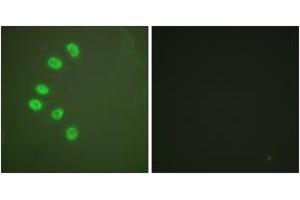Immunofluorescence (IF) image for anti-Progesterone Receptor (PGR) (AA 261-310) antibody (ABIN2888697) (Progesterone Receptor Antikörper  (AA 261-310))