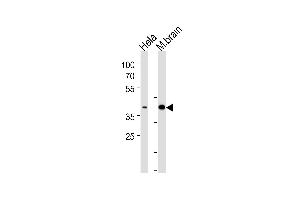 ATF2 Antibody (p) (ABIN1538301 and ABIN2848542) western blot analysis in Hela cell line and mouse brain tissue lysates (35 μg/lane). (ATF2 Antikörper  (AA 318-347))