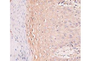 Immunohistochemistry of paraffin-embedded Human skin using CDH3 Polyclonal Antibody at dilution of 1:100 (40x lens). (P-Cadherin Antikörper)