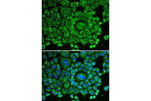 Immunofluorescence analysis of HeLa cells using ARHGDIA antibody (ABIN5970556). (ARHGDIA Antikörper)