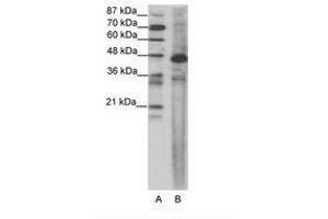 Image no. 1 for anti-Serum Response Factor (SRF) (AA 120-169) antibody (ABIN202686) (SRF Antikörper  (AA 120-169))