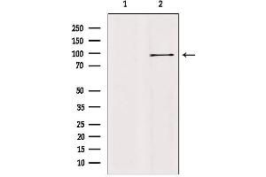 Western blot analysis of extracts from mouse brain, using AAK1 Antibody. (AAK1 Antikörper  (Internal Region))