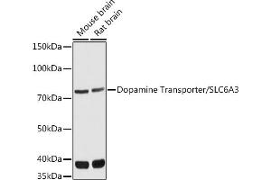 Western blot analysis of extracts of various cell lines, using Dopamine Transporter/SLC6 antibody (ABIN7270474) at 1:1000 dilution. (SLC6A3 Antikörper  (C-Term))