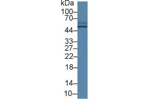 Western blot analysis of Pig Small intestine lysate, using Human TCN2 Antibody (2 µg/ml) and HRP-conjugated Goat Anti-Rabbit antibody ( (TCN2 Antikörper  (AA 19-427))