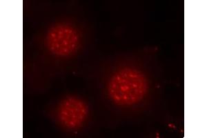 Immunofluorescence analysis of methanol-fixed MCF-7 cells using Phospho-FOXO4-S197 antibody (ABIN3019724, ABIN3019725, ABIN3019726 and ABIN1681609). (FOXO4 Antikörper  (pSer197))