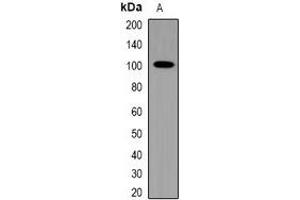 Western blot analysis of TRPV4 expression in HepG2 (A) whole cell lysates. (TRPV4 Antikörper)