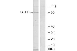 Immunohistochemistry analysis of paraffin-embedded human brain tissue using CDH3 antibody. (P-Cadherin Antikörper)