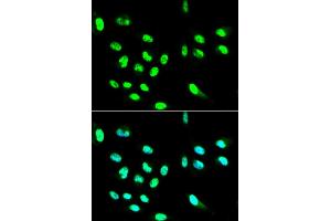 Immunofluorescence analysis of HepG2 cells using FCGR2A antibody (ABIN5970646). (FCGR2A Antikörper)