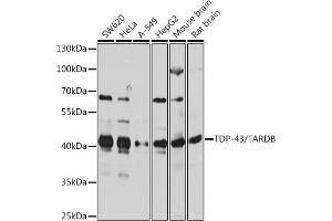 Western blot analysis of extracts of various cell lines, using TDP-43/TARDB antibody  at 1:1000 dilution. (TARDBP Antikörper  (AA 1-100))