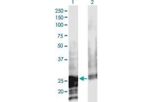 Western Blot analysis of NOL3 expression in transfected 293T cell line by NOL3 monoclonal antibody (M02), clone 3A9. (NOL3 Antikörper  (AA 1-208))