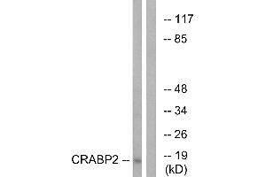 Western blot analysis of extracts from HT-29 cells, using CRABP2 antibody. (CRABP2 Antikörper)