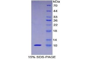 SDS-PAGE analysis of Human PKIa Protein. (PKIA Protein)