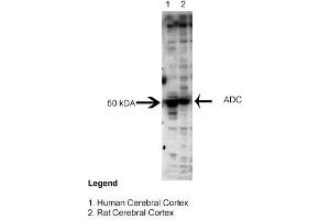 Sample Type: Human and Rat Cerebral CortexPrimary Dilution: 1:3000 (ADC Antikörper  (Middle Region))