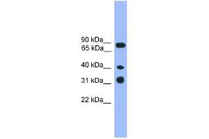 WB Suggested Anti-LAX1 Antibody Titration: 0. (LAX1 Antikörper  (C-Term))