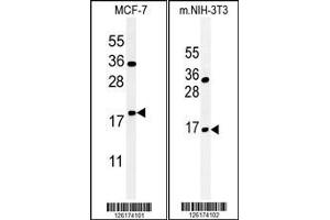 (LEFT)Western blot analysis of BTG1 Antibody in MCF-7 cell line lysates (35ug/lane). (BTG1 Antikörper  (AA 92-118))