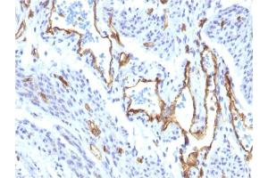 Immunohistochemistry (IHC) image for anti-Platelet/endothelial Cell Adhesion Molecule (PECAM1) antibody (ABIN6940290)