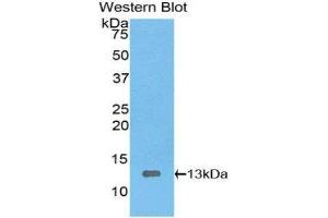 Western Blotting (WB) image for anti-High Mobility Group AT-Hook 1 (HMGA1) (AA 1-107) antibody (ABIN3205547) (HMGA1 Antikörper  (AA 1-107))