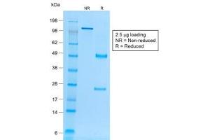 SDS-PAGE analysis of purified, BSA-free recombinant Ep-CAM antibody (clone rVU-1D9) as confirmation of integrity and purity. (Rekombinanter EpCAM Antikörper)
