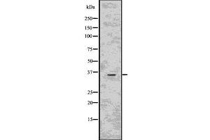 Western blot analysis of CD40LG using HepG2 whole  lysates. (CD40 Ligand Antikörper  (Internal Region))