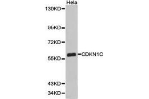Western Blotting (WB) image for anti-Cyclin-Dependent Kinase Inhibitor 1C (p57, Kip2) (CDKN1C) antibody (ABIN1871758) (CDKN1C Antikörper)