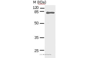 Western blot analysis of Human fetal lung tissue, using STAT5A Polyclonal Antibody at dilution of 1:450 (STAT5A Antikörper)