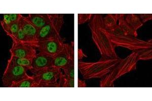 Confocal immunofluorescence analysis of NTERA-2 cells (left) and HeLa cells (right) using Nanog antibody (green). (Nanog Antikörper  (AA 20-166))