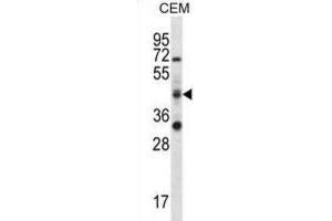 Western Blotting (WB) image for anti-RNA Binding Motif Protein 42 (RBM42) antibody (ABIN2996736) (RBM42 Antikörper)