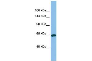 Host:  Rabbit  Target Name:  TPO  Sample Type:  Jurkat Whole Cell lysates  Antibody Dilution:  1. (Thyroperoxidase Antikörper  (N-Term))