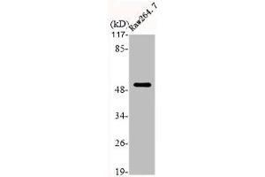 Western Blot analysis of RAE264. (Cytokeratin 7 Antikörper  (C-Term))