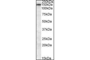 Image no. 2 for anti-ATP-Binding Cassette, Sub-Family C (CFTR/MRP), Member 5 (ABCC5) (N-Term) antibody (ABIN372570) (ABCC5 Antikörper  (N-Term))