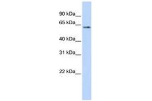 Image no. 1 for anti-Tumor Protein P53 (TP53) (AA 36-85) antibody (ABIN6742186) (p53 Antikörper  (AA 36-85))