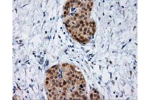 Immunohistochemical staining of paraffin-embedded Kidney tissue using anti-IFT57 mouse monoclonal antibody. (IFT57 Antikörper)