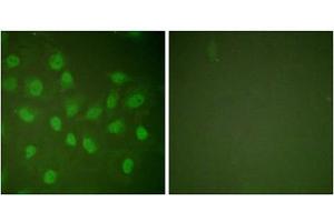 Immunofluorescence analysis of HeLa cells, treated with PMA (125ng/ml, 30mins), using POLR2A (epitope around residue 1619) antibody (ABIN5976162). (POLR2A/RPB1 Antikörper  (Ser1619))