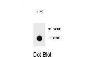 Dot blot analysis of Phospho-PTEN- Antibody Phospho-specific Pab (ABIN6241049 and ABIN6578935) on nitrocellulose membrane. (PTEN Antikörper  (pSer362))