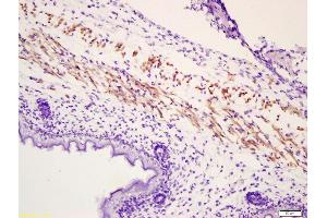 Formalin-fixed and paraffin embedded mouse embryonic muscle labeled with Anti-Phospho-MYL(Ser19) Polyclonal Antibody, Unconjugated (ABIN744188) at 1:200 followed by conjugation to the secondary antibody and DAB staining (PML Antikörper  (pSer19))