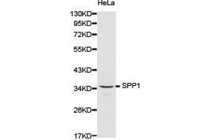 Western Blotting (WB) image for anti-Secreted phosphoprotein 1 (SPP1) antibody (ABIN1874926) (Osteopontin Antikörper)
