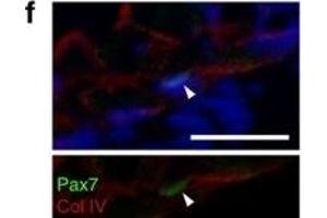 Immunofluorescence (Paraffin-embedded Sections) (IF (p)) image for anti-Collagen, Type IV (COL4) antibody (ABIN5596835)