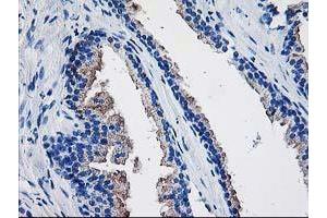 Immunohistochemistry (IHC) image for anti-TBC1 Domain Family, Member 21 (TBC1D21) antibody (ABIN1501312) (TBC1D21 Antikörper)