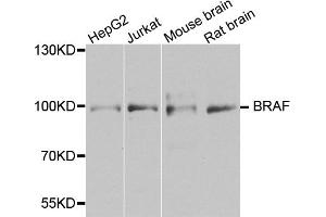 Western blot analysis of extracts of various cell lines, using BRAF antibody (ABIN5974879) at 1/1000 dilution. (BRAF Antikörper)