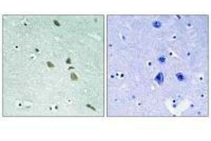 Immunohistochemistry analysis of paraffin-embedded human brain tissue using ILK (Ab-246) antibody. (ILK Antikörper  (Ser246))