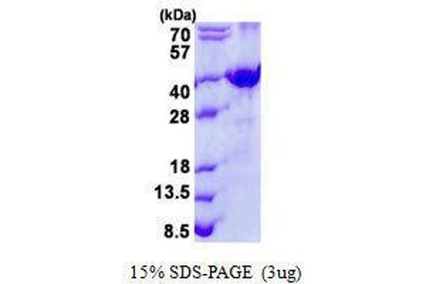 FRZB Protein