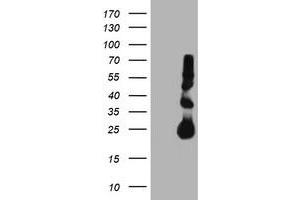 HEK293T cells were transfected with the pCMV6-ENTRY control (Left lane) or pCMV6-ENTRY TIMP2 (Right lane) cDNA for 48 hrs and lysed. (TIMP2 Antikörper)