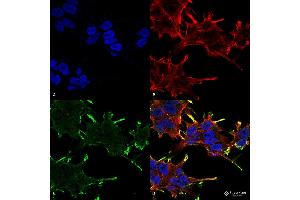 Immunocytochemistry/Immunofluorescence analysis using Mouse Anti-Alpha B Crystallin Monoclonal Antibody, Clone 1A7. (CRYAB Antikörper  (PerCP))